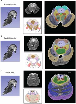 3D Exploration of the Brainstem in 50-Micron Resolution MRI